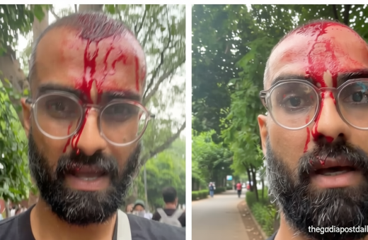 ‘Never thought this is how my face reveal would happen’: Ramit Verma, aka PeeingHuman injured during CJP protest