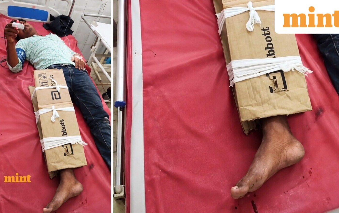 ‘Just bihar things’: Man with fractured leg gets cardboard support; social media reacts to viral video