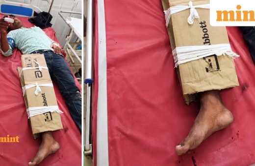‘Just bihar things’: Man with fractured leg gets cardboard support; social media reacts to viral video