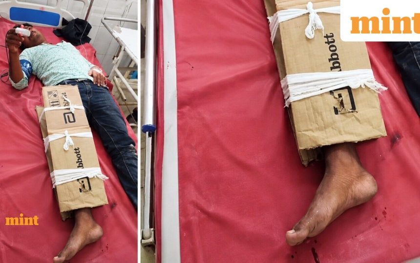 ‘Just bihar things’: Man with fractured leg gets cardboard support; social media reacts to viral video